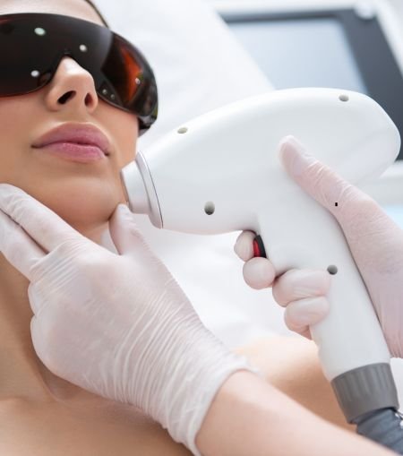 Laser Hair Removal