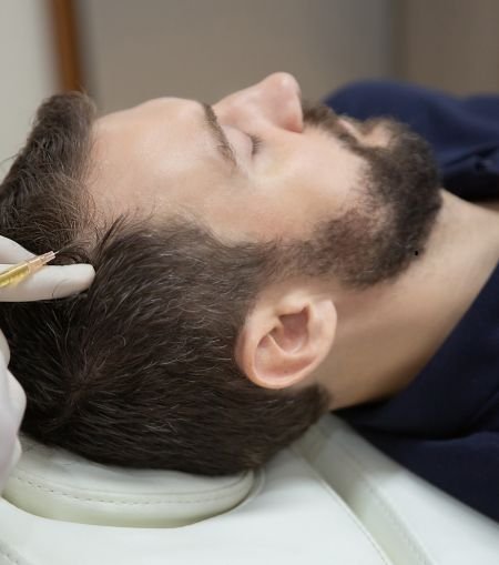 PRP for Hair