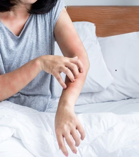 Skin Allergy